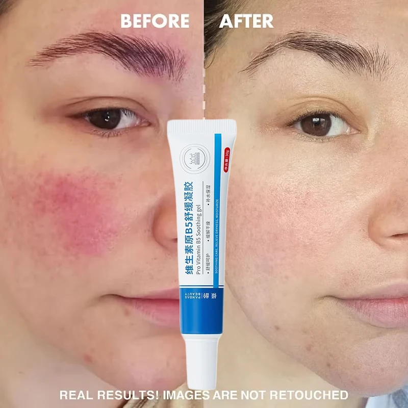 Provitamin B5 успокаивающий гель против покраснений восстанавливающий барьер для лица