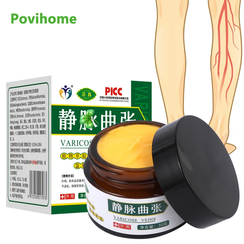 

30g Varicose Veins Relief Cream Leg Vasculitis Phlebitis Spider Shape Vein Pain Relief Ointment Chinese Herbal Medical Plaster