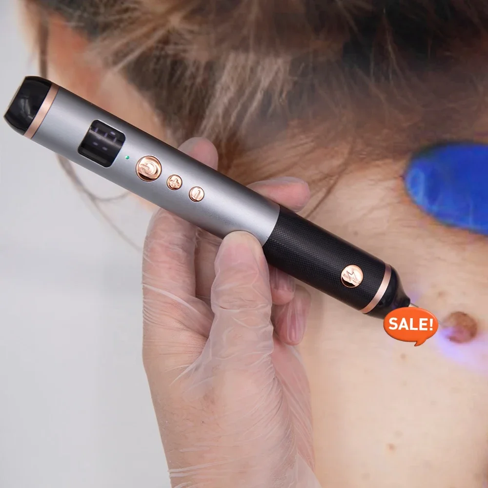 Плазменное удаление бородавок кожи лица электрическое приспособление папилломы