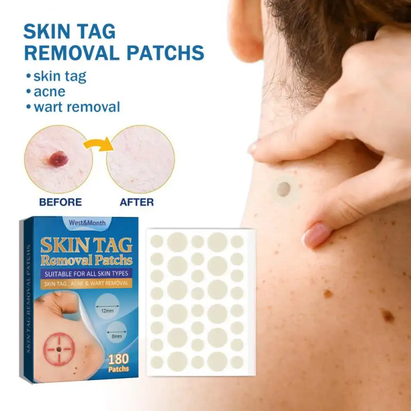 

/box Skin Tag Treatments Stickers Warts Mole Pimples Remove Patches Foot Corn Plaster Invisible Acne Sticker Skin Care