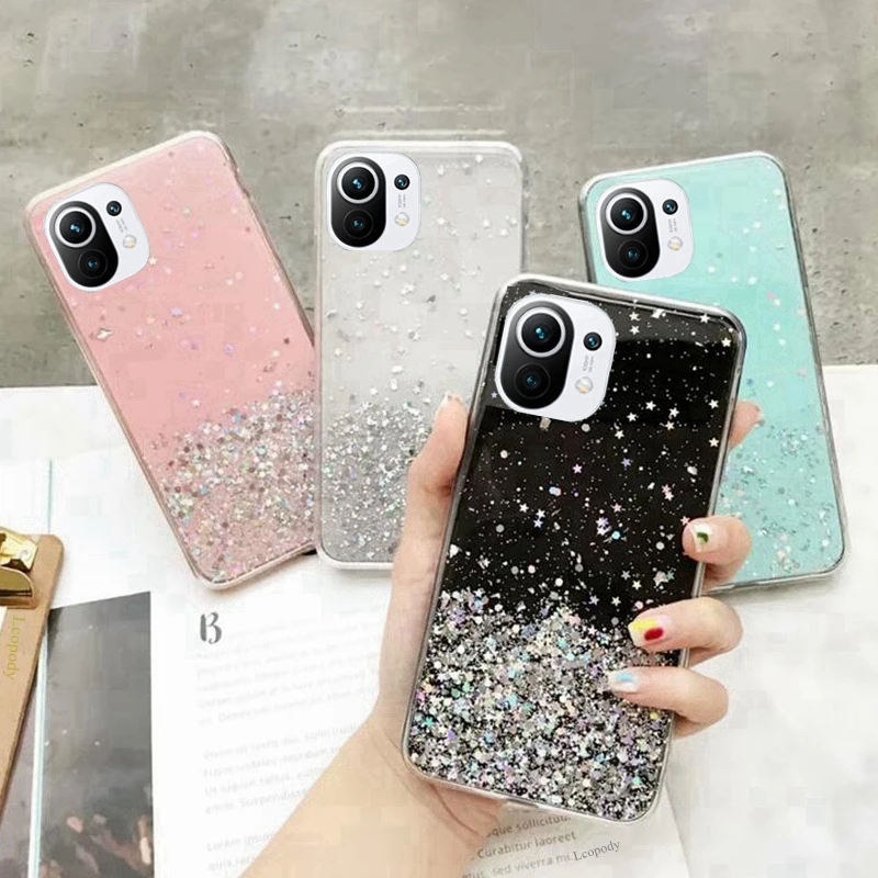 

Funda For Xiaomi Mi 11 Lite 5G Case Luxury Bling Glitter Cover Xiaomi Mi 11T Pro 11TPro 11 Ultra Pro Soft Silicone Phone Covers