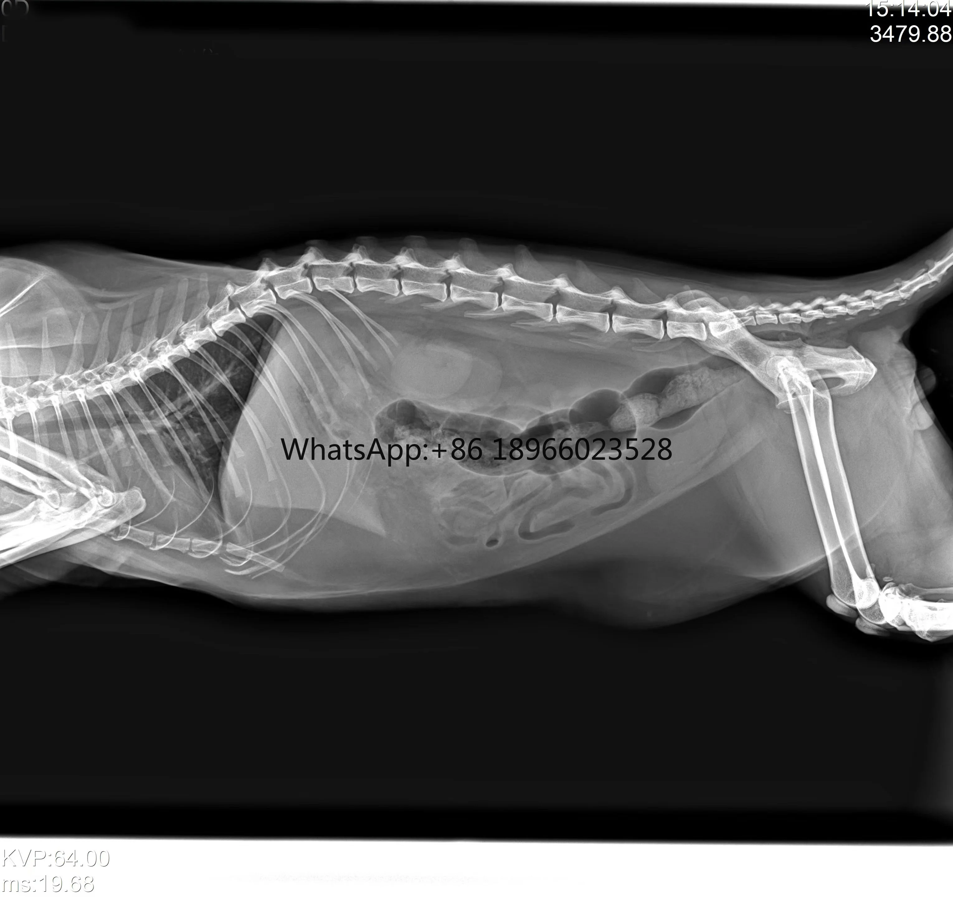 Высококачественный цифровой радиографический плоский панельный детектор Iray Mars