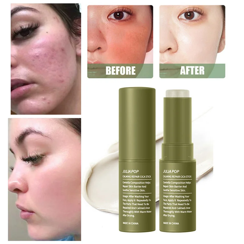 

Repair Facial Redness Multi Bounce Balm Stick Centella Asiatica Moisturizing Repair Soothing Sensitive Skin Korean Cosmetics