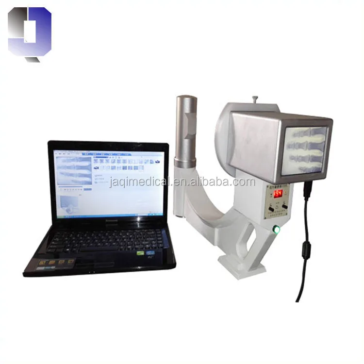 

JQ-100A Portable X-ray machine mainly for human and animal Orthopaedic Hand and Foot Surgery emergency examination