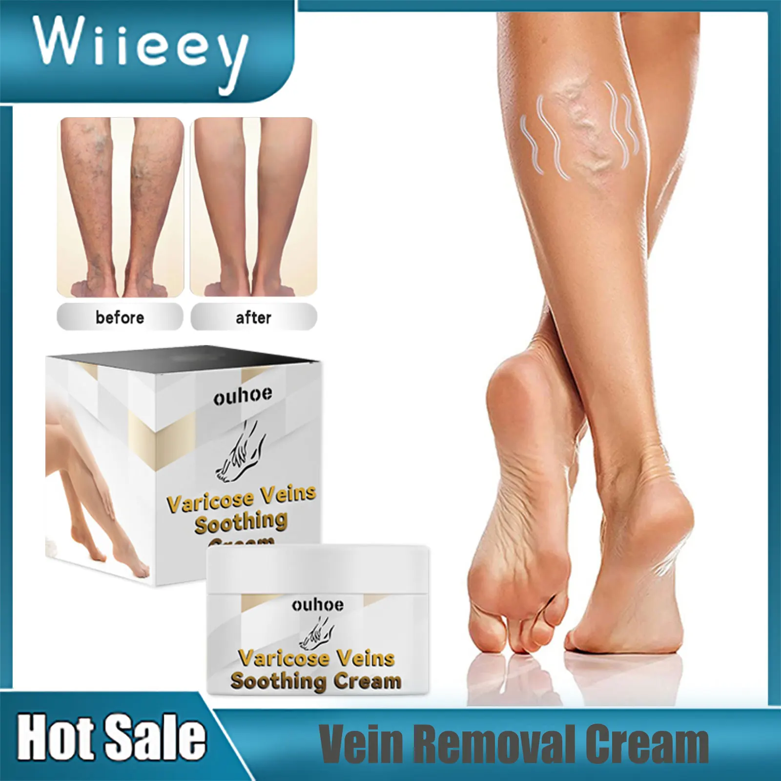 

Relief Phlebitis Cream Eliminating Vasculitis Soothing Earthworm Spider Legs Treatment Angiitis Pain Varicose Vein Removal Cream