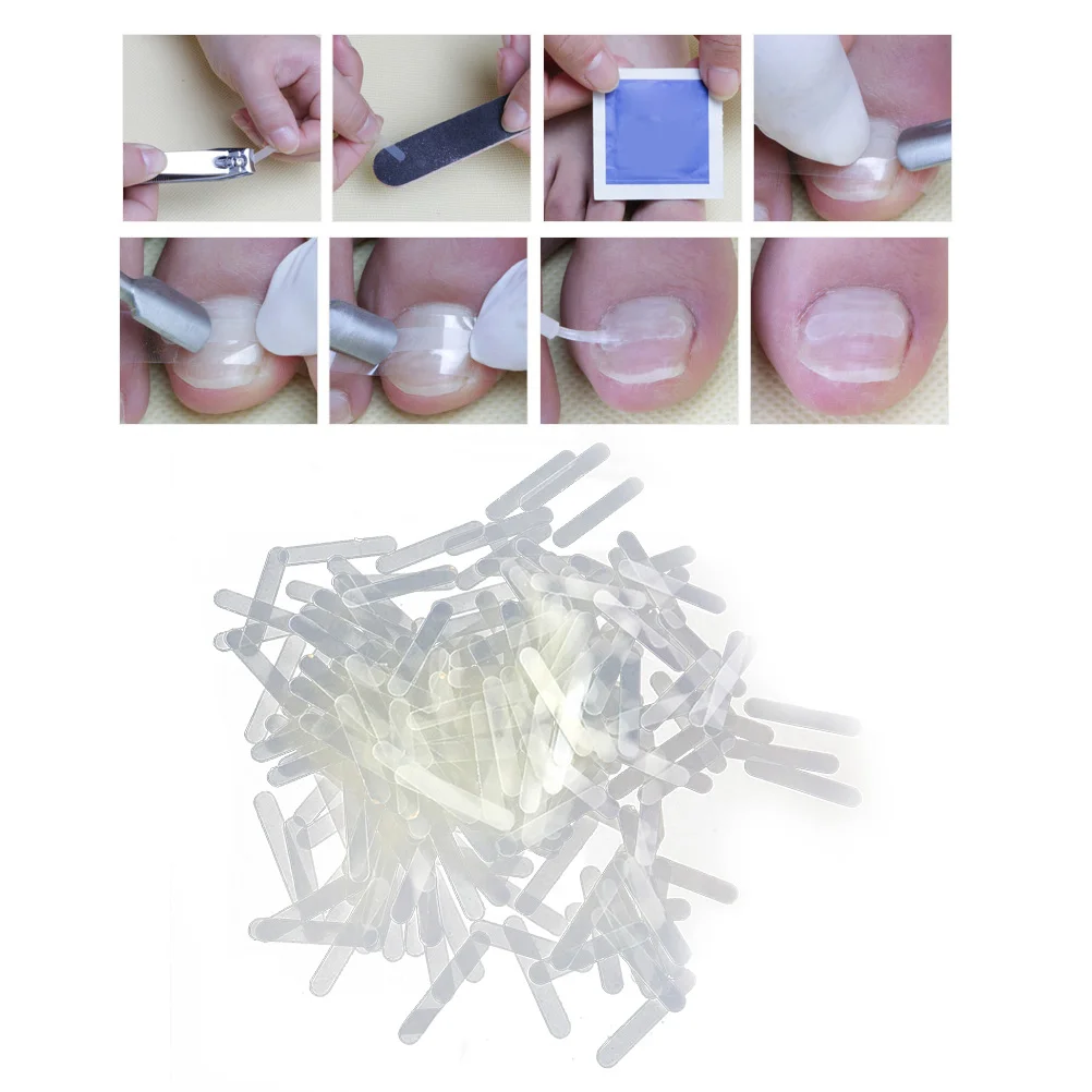 

120pcs Sticker Patch Nail Correction Sticker Nail Repair Toenail Corrector Stickers Toe Correction Sticker
