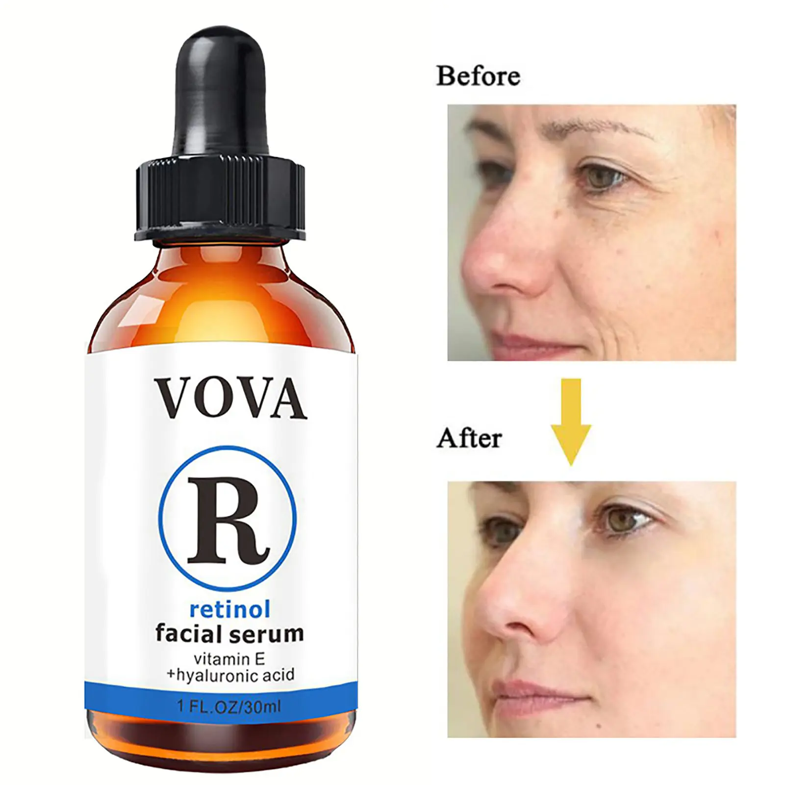 

Retinol Facial Serum Moisturizing Brightening Facial Essence Anti Aging Serum With Hyaluronic Acid Fine Lines And Wrinkles 1 Fl