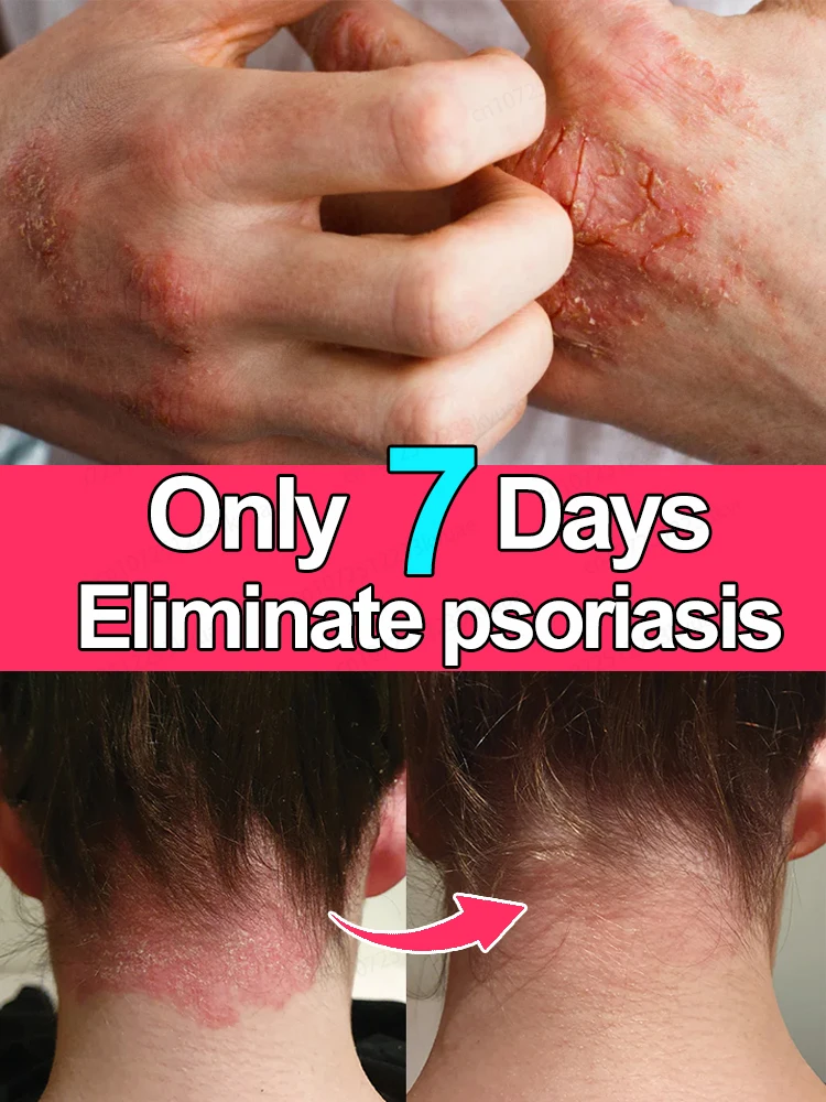 ᴾˢᵒʳⁱᵃˢⁱˢ ᶜʳᵉᵃᵐ