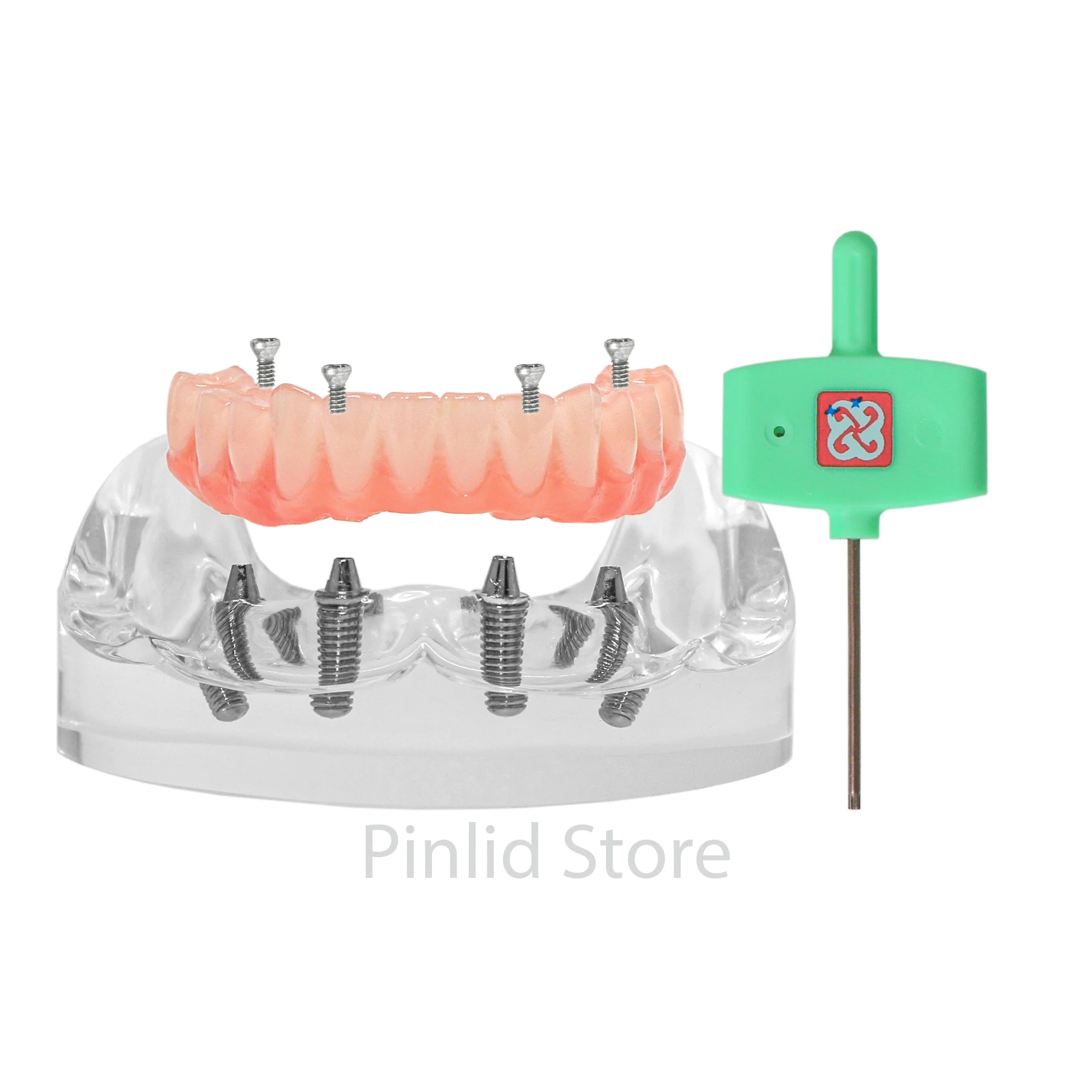 Стоматологическая модель реставрации нижнего имплантата 4 съемных винта с