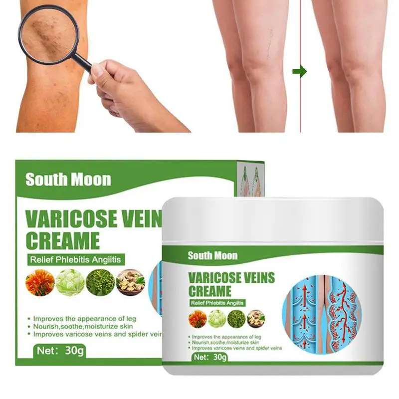 

1.05oz Varicose Vein Relief Cream Leg Swelling Care Ointment Natural Formula With Organic Ingredients Red Blood Leg Repair