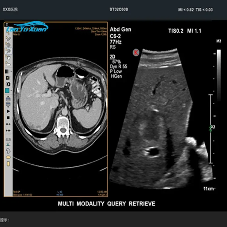 Рисунок 6 - Портативный цифровой цветной допплер