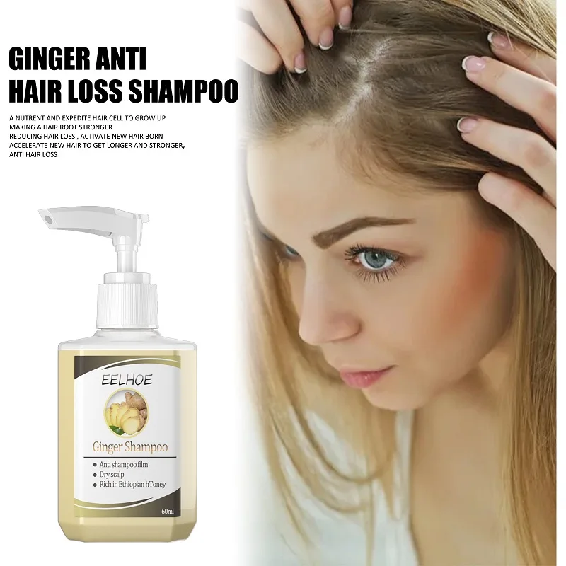 

Herbal Ginger Hair Shampoo Anti Dandruff Anti-Itching Cleansing Oil Control Hair Scalp Treatment Hair Growth Prevent Hair Loss