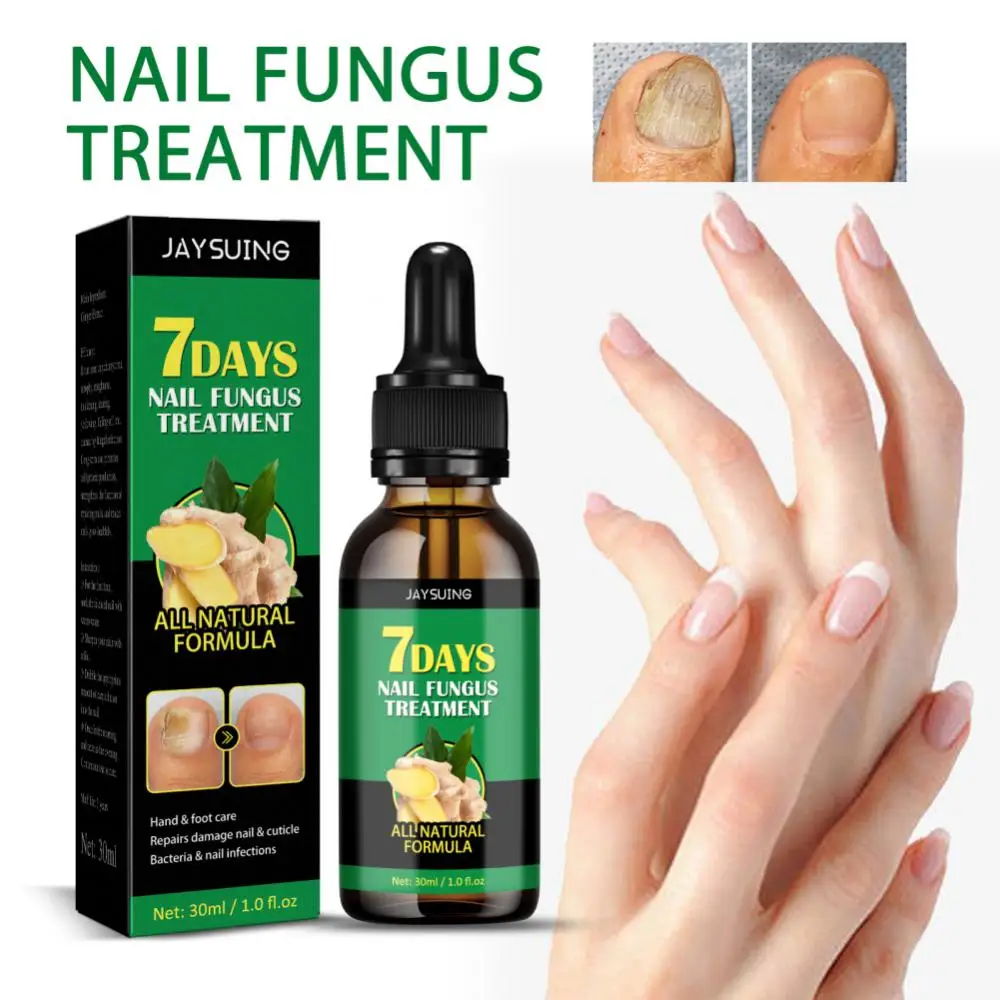 

Hand Foot Nail Care 30ml Paronychia Onychomycosis Care Nail Soft Repair Nail Fungus Removal Beauty Heath Nail Fungus Care Tool