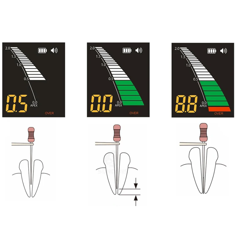 3 5-дюймовый экранирующий эндолокатор Апекслокатор для стоматологии