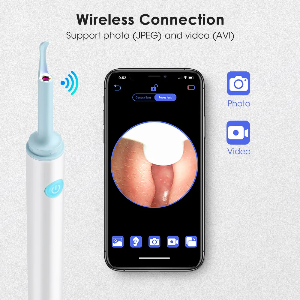 Фото 5MP WIFI Электрический цифровой отоскоп, очиститель ушного воска, эндоскоп, беспроводной визуальный захват ушей, инструмент для удаления ушног... №3
