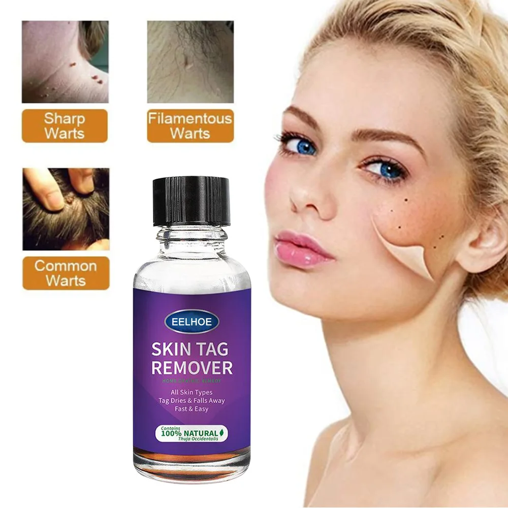 

1Pc Skin Wart Removal Agents Address Skin Wart Skin Care 10ml