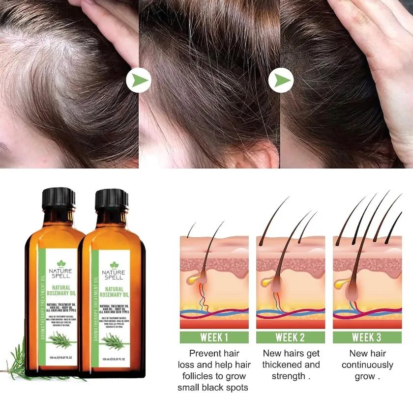 

Эфирное масло розмарина для роста волос и ухода за кожей, масло для лечения выпадения волос