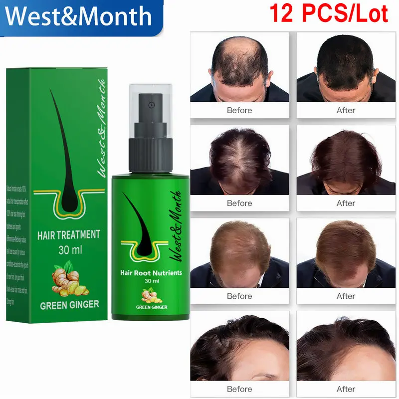 3/5/8/12 PCS Ginger Hair Growth Products Natural Anti Hair L