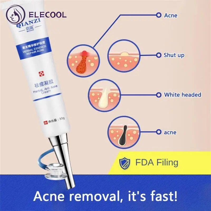 

Boxed Acne Cream Formula Acne Ointment Facial Products Cream Skin Repair 30g Skin Care Products Support Acne Gel
