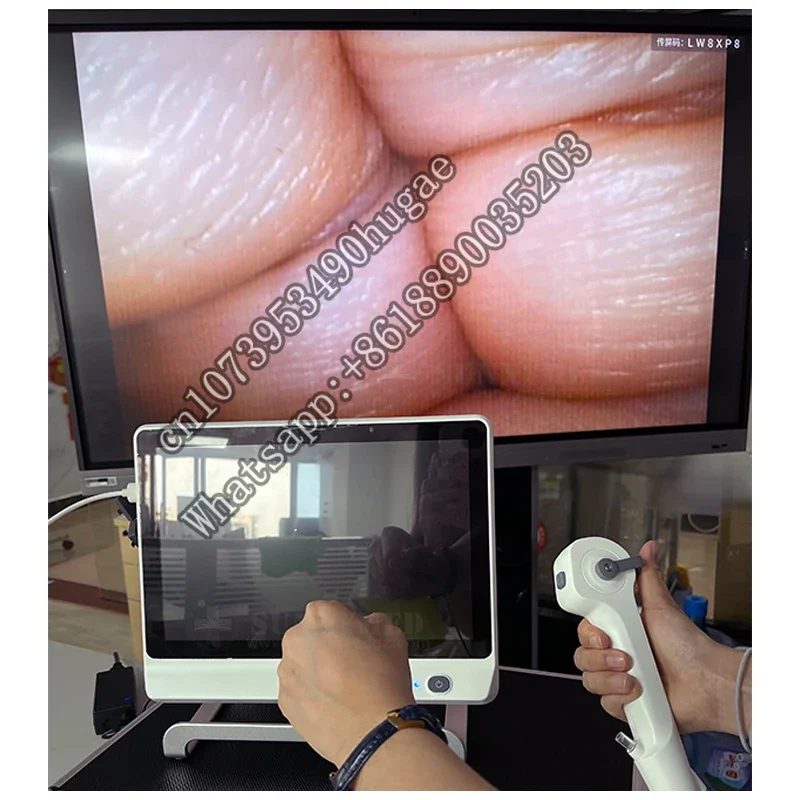 SY-P029-3 высококачественный одноразовый уретероскоп Полужесткий видео гибкий