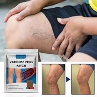 vein relief post unclog varicose blood vessel nodules spider legs earthworm bulge relieve tendon and vein external application