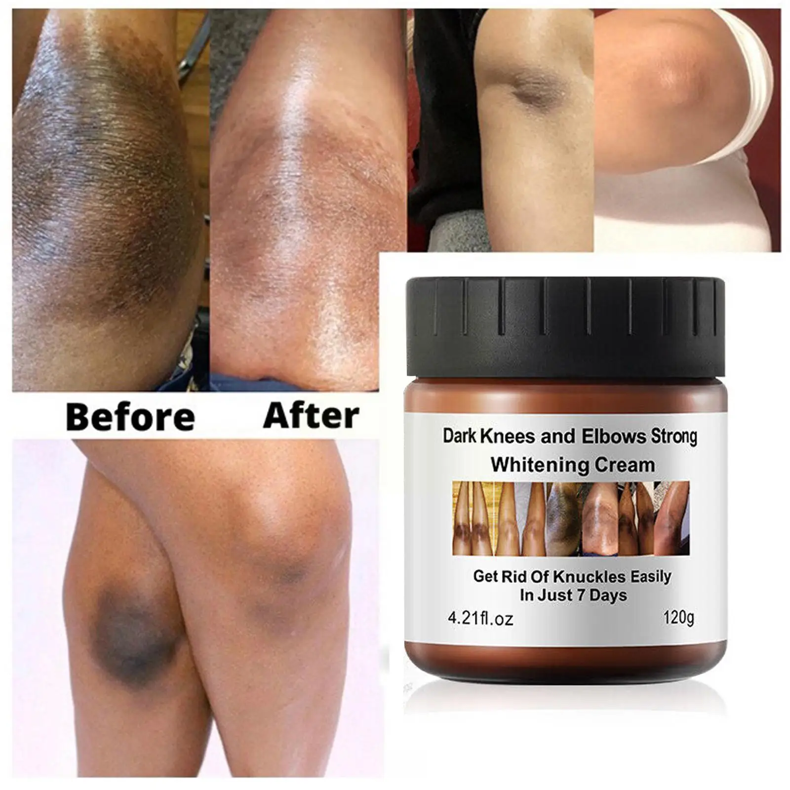 Крем увлажняющий для локтей. Отбеливающий крем для тела. Крем для отбеливания локтей. Крем для отбеливания локтей. Крем увлажняющий для локтей.