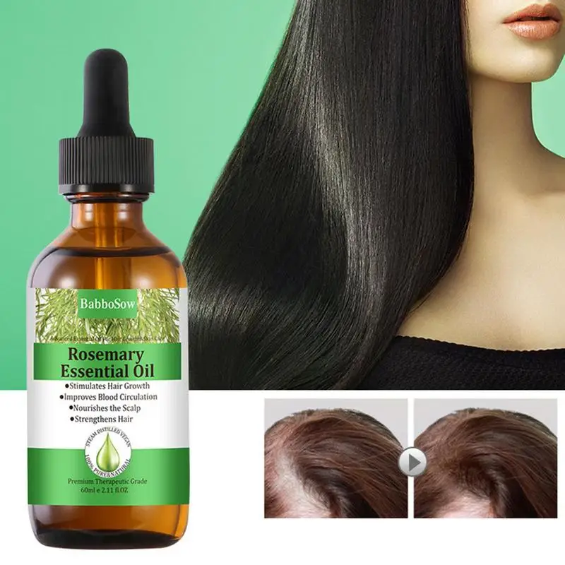 

Sdotter Rosemary Hair Oil 60ml Anti Hair Loss Fast Growth Essence For Baldness Scalp Damaged Hairs Repair Regrowth Natural Tonic