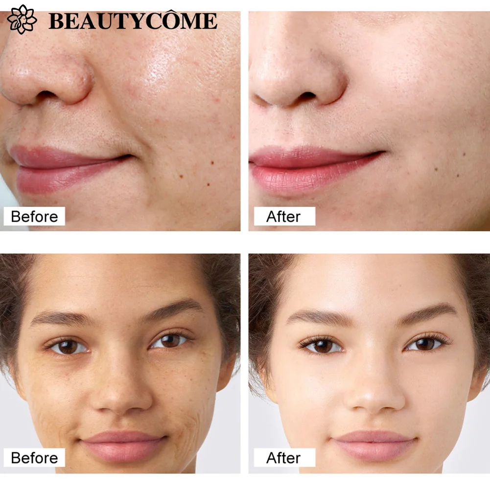 Крем для лица от морщин ретинол |