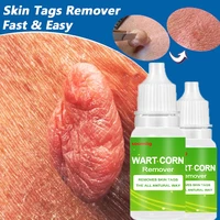 treatment papillomas removal of warts liquid kill remover foot corn skin tag mole amp genital wart remover remedy skin care