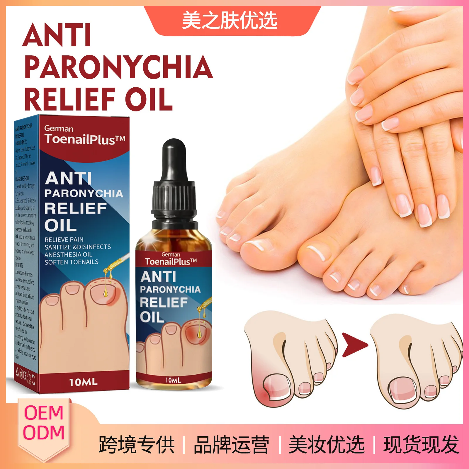 

Anti Paronychia Relief Oil Ingrown Toenail Drops Anti Fungal Toe Nail Ingrown Corrector Stop Pain Onychomycosis Treatment Serum