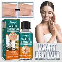 skin tags remover painless mole skin dark spot warts remover serum freckle face wart tag treatment removal cream essential oil