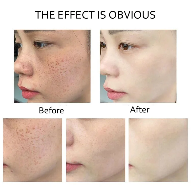 Сыворотка с ретинолом против морщин выцветание темных пятен витамин С сыворотка