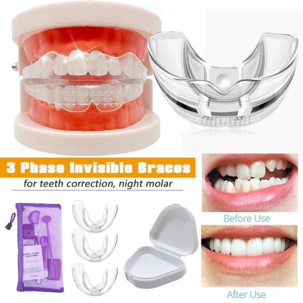 

Orthodontic Braces Appliance Dental Braces Silicone Alignment Trainer Teeth Retainer Bruxism Mouth Duard Teeth Straightener Tool