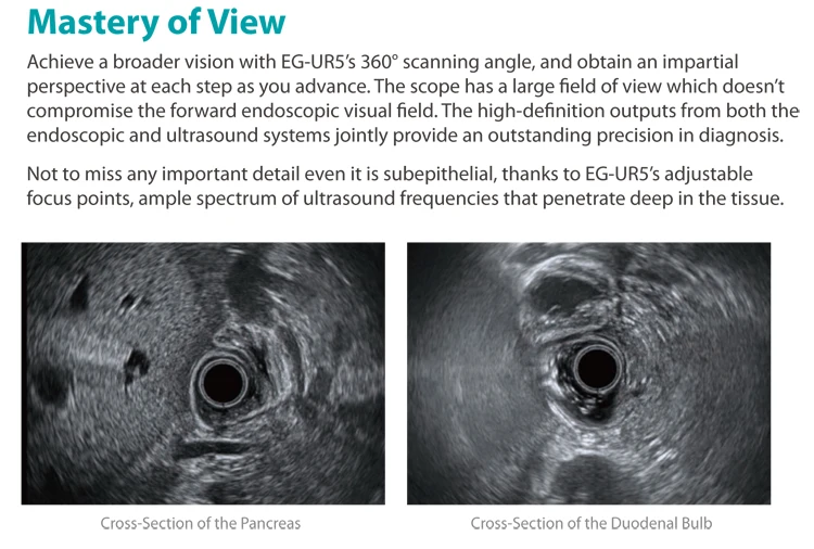 Соноскоп EUS 360 дюймов радиальный эхоендоскоп эндоскопический ультразвуковой