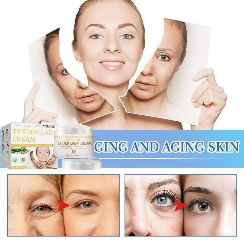 

Bifid Yeast Whitening Freckles Cream Remove Melasma Dark Spot Acne Marks Lightening Melanin Brightens Skin Tone Face Skin Care