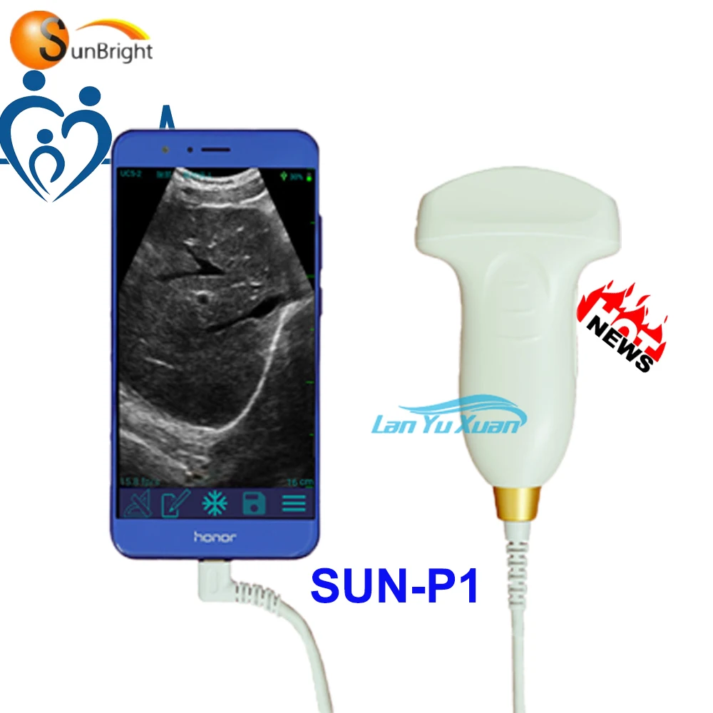 

China Popular wireless portable ultrasound usb probe mobile phone scanner