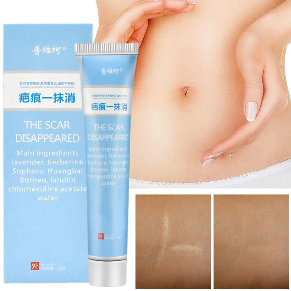 

Skin Scar Removal Cream For Burns, Surgery, Plastic Surgery, Hyperplasia/acne Marks, Stretch Marks, Pigment H1s3