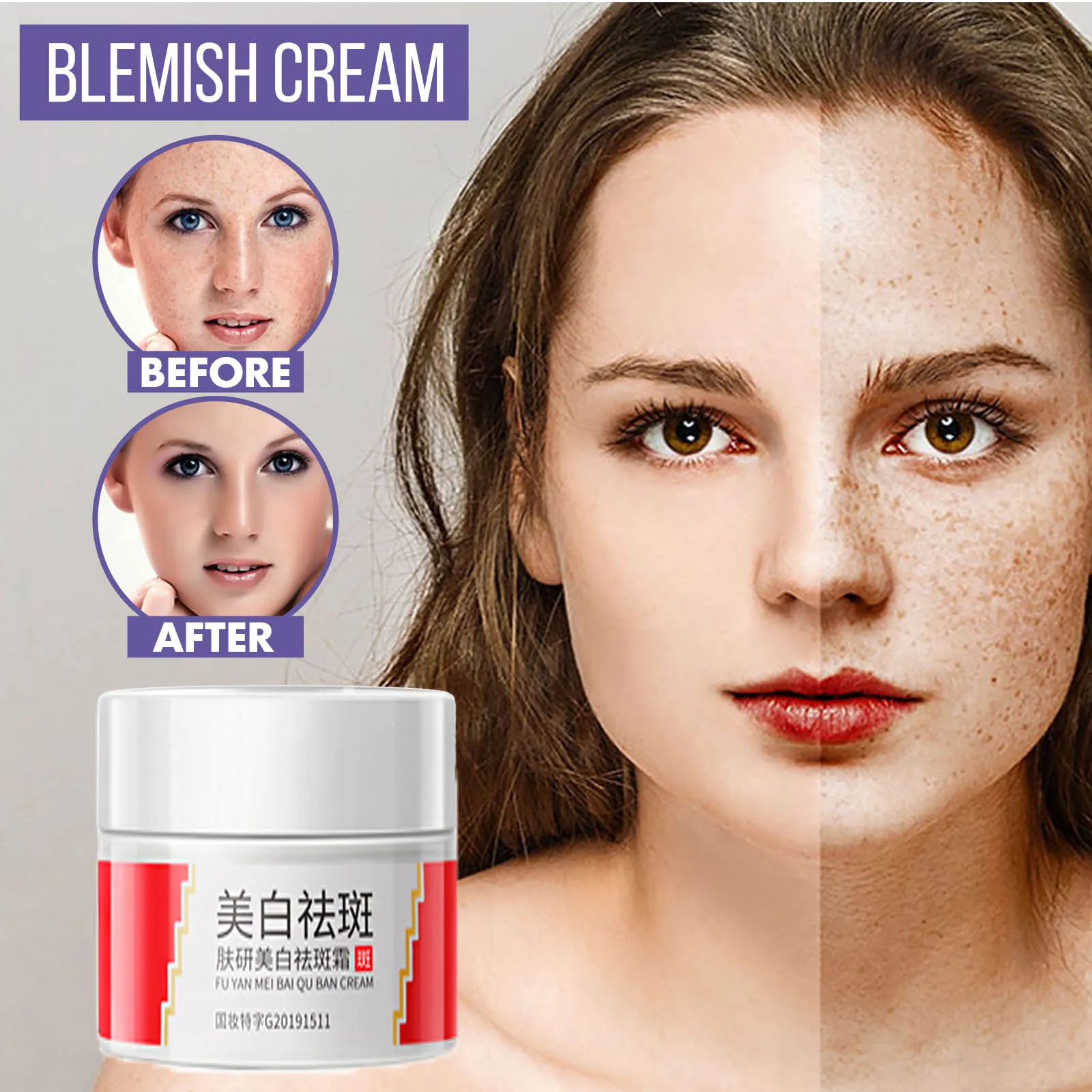 

Увлажняющий крем против веснушек, увлажняющий крем против морщин, уход за кожей