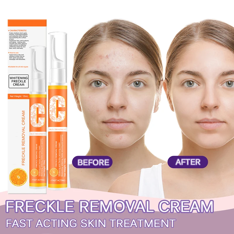 

Freckle Remove Instant Blemish Removal Gel VC Whitening Freckle Cream Pen Brighten Whiten Skin Remove Pigmented Melanin Spots