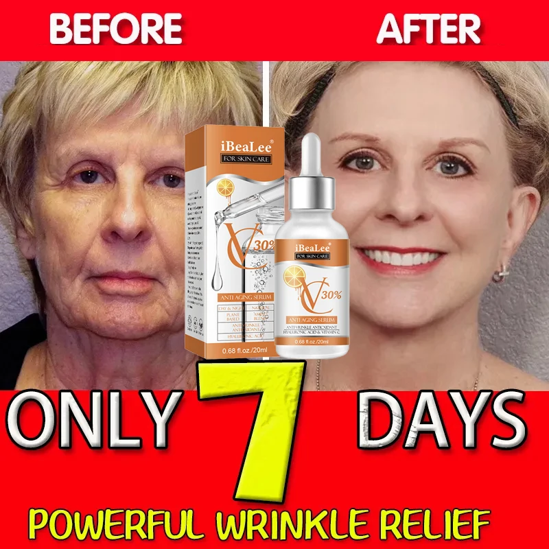 

Sdotter Premium 30% Vitamin C Serum For Face Anti Aging Wrinkle Facial Hyaluronic Acid Retinol Acids Boost Collagen Hydrate Skin