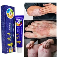 herbal anti fungal spray salicylic acid essence anti itch treatment psoriasis dermatitis eczema skin rash body repair skin care