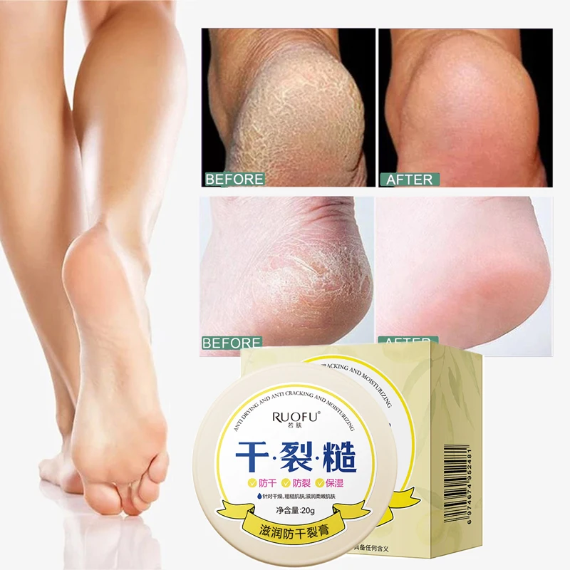 Foot Heel Hand Lip Face Cracked Repair Oils Anti-freeze Removal Wrinkle Dead Skin Whitening Body Care