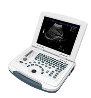 cheapest price laptop digital 15 inch 2d 3d 4d obstetric gynecology ultrasound medical scanner medical ultrasound instruments