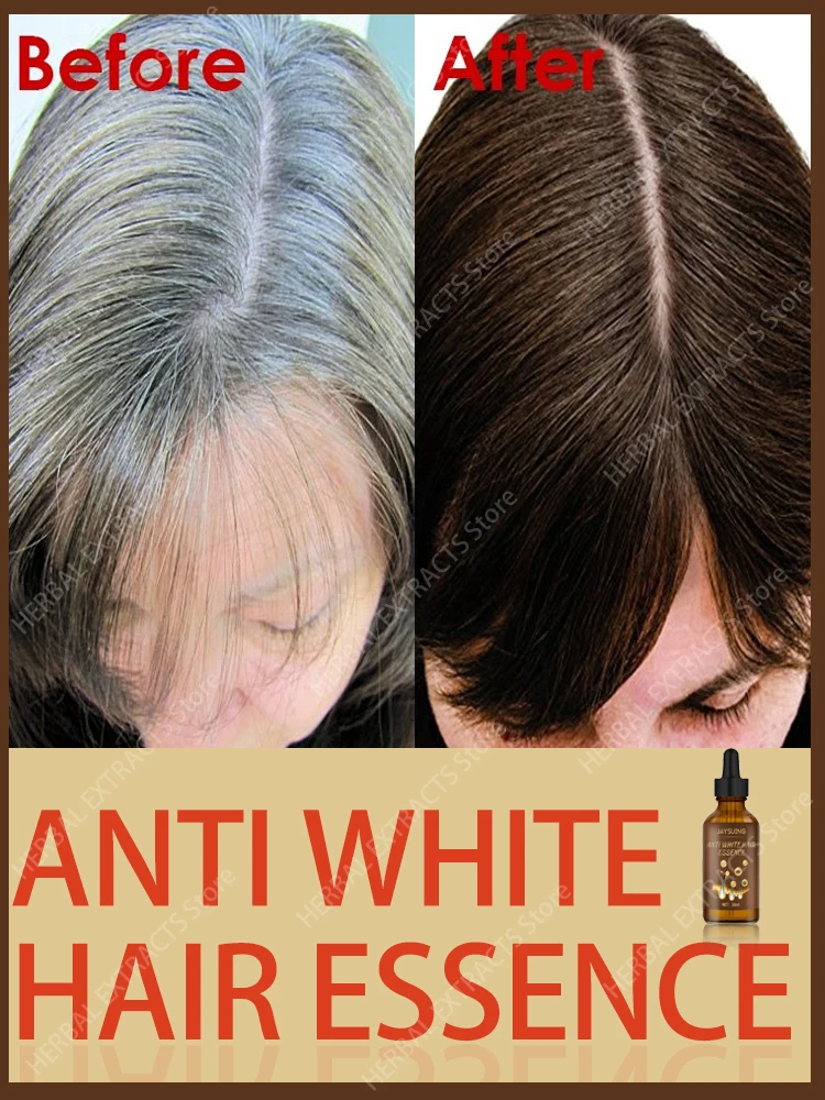 

Anti Gray Hair Serum Remedy White Darkening Products