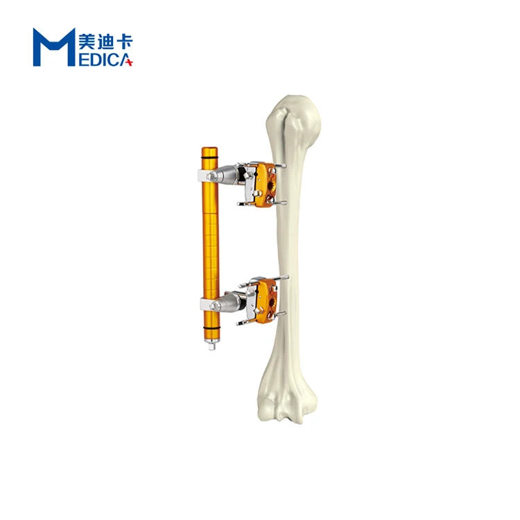 

hoffman external fixator orthopedic instruments stryker for radius Surgical fixation set humerus