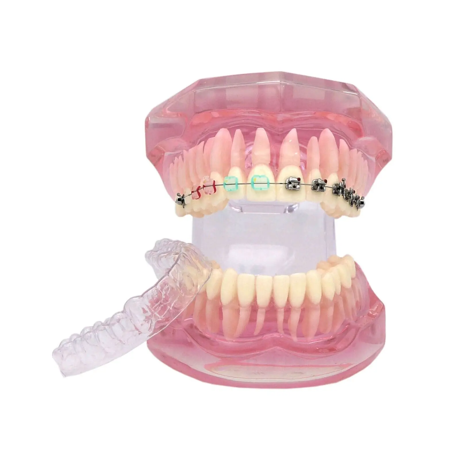 Dental Teeth Orthodontic Model Retainer With Metal Self-ligating Ceramic Bracket