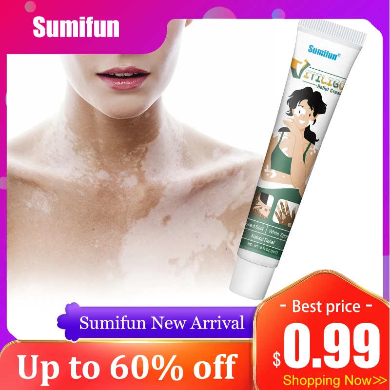 

20g Sumifun Vitiligo Treatment Cream Skin White Spot Remover Ointment Herbal Localized Leukoplakia Repair Chinese Medicine 2023