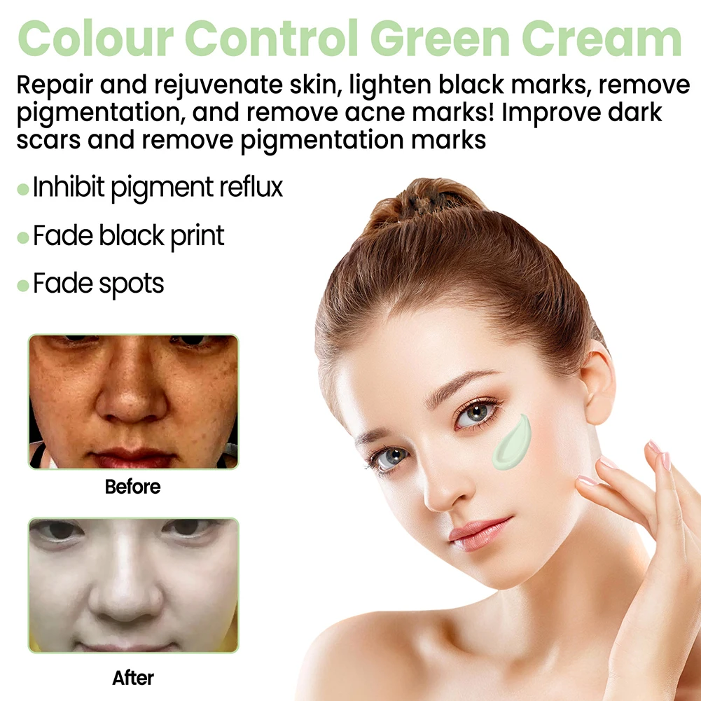 

Зеленый крем с контролем цвета, гиммелазма, фотокрем с темными пятнами, 30 г