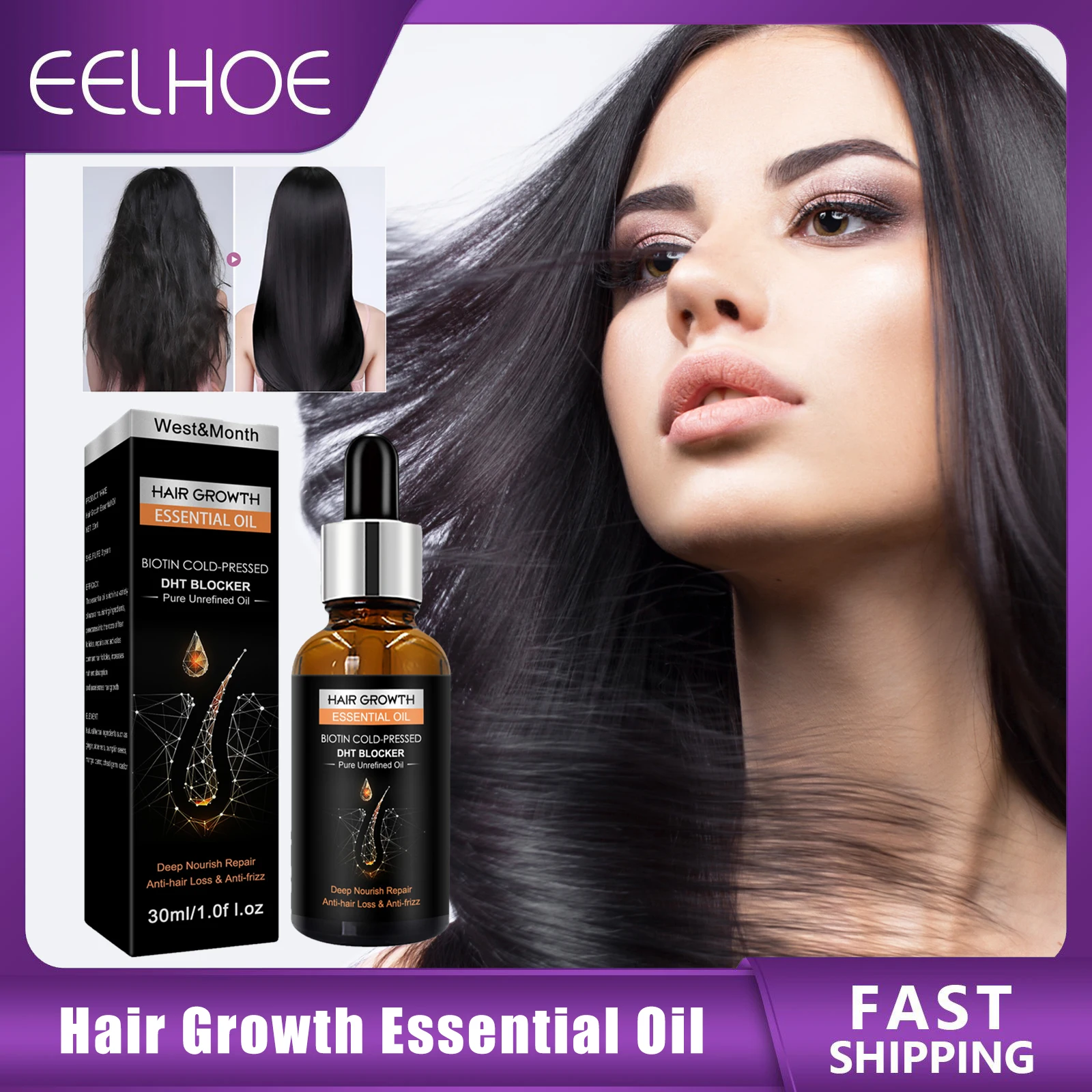 

Hair Growth Essential Oil Prevent Hair Loss Fast Growing Scalp Treatment Improve Frizz Repair Nourish Dry Hair Care Product 30ml