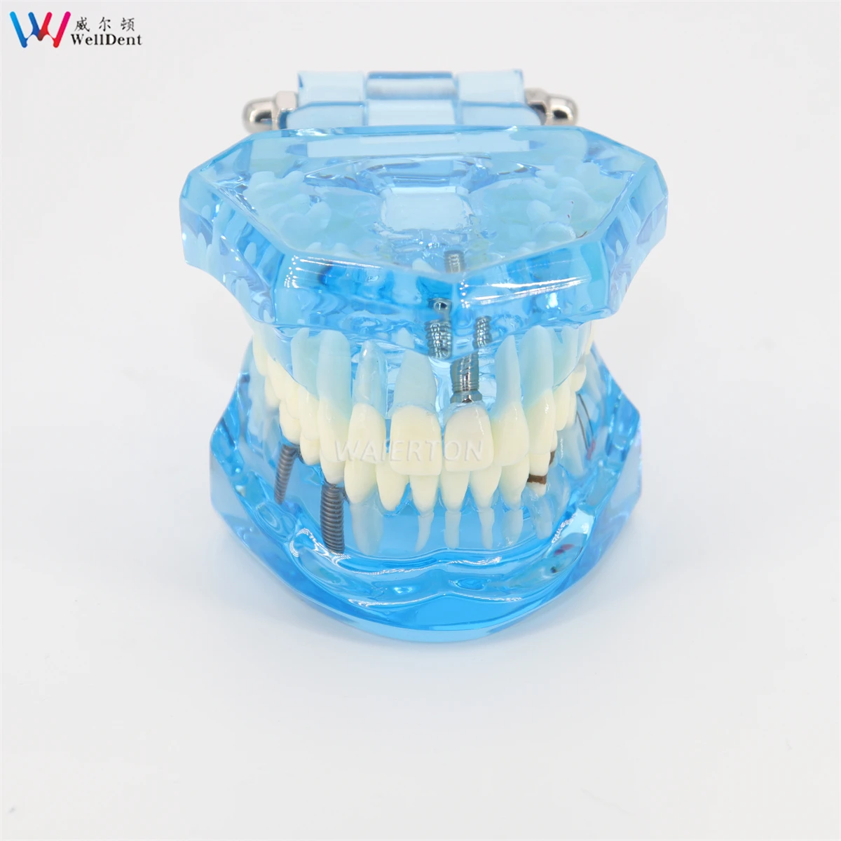 Зубная модель для обучения зубы взрослых патологические Обучающие новая Denshine